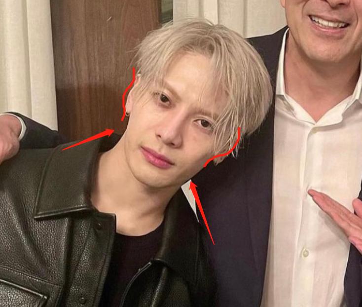 深度解析明星整容后遺癥，觀點與影響探討