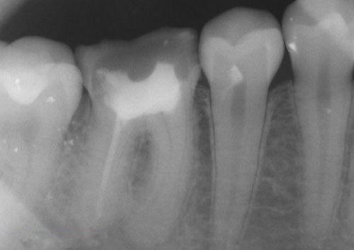 中國再生牙齒研究新進展，重塑微笑，科技引領牙齒再生新篇章