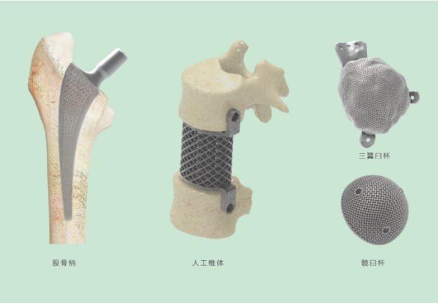 三維打印髖關(guān)節(jié)技術(shù)新動態(tài)，重塑生活的科技魔法奇跡