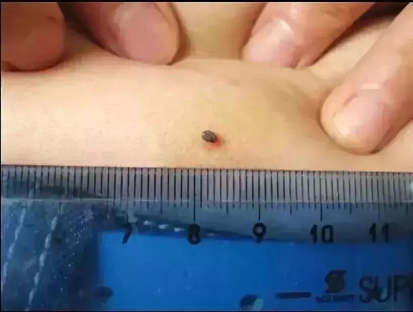 小明快樂(lè)疫情日志，最新疫情發(fā)布與日常觀察