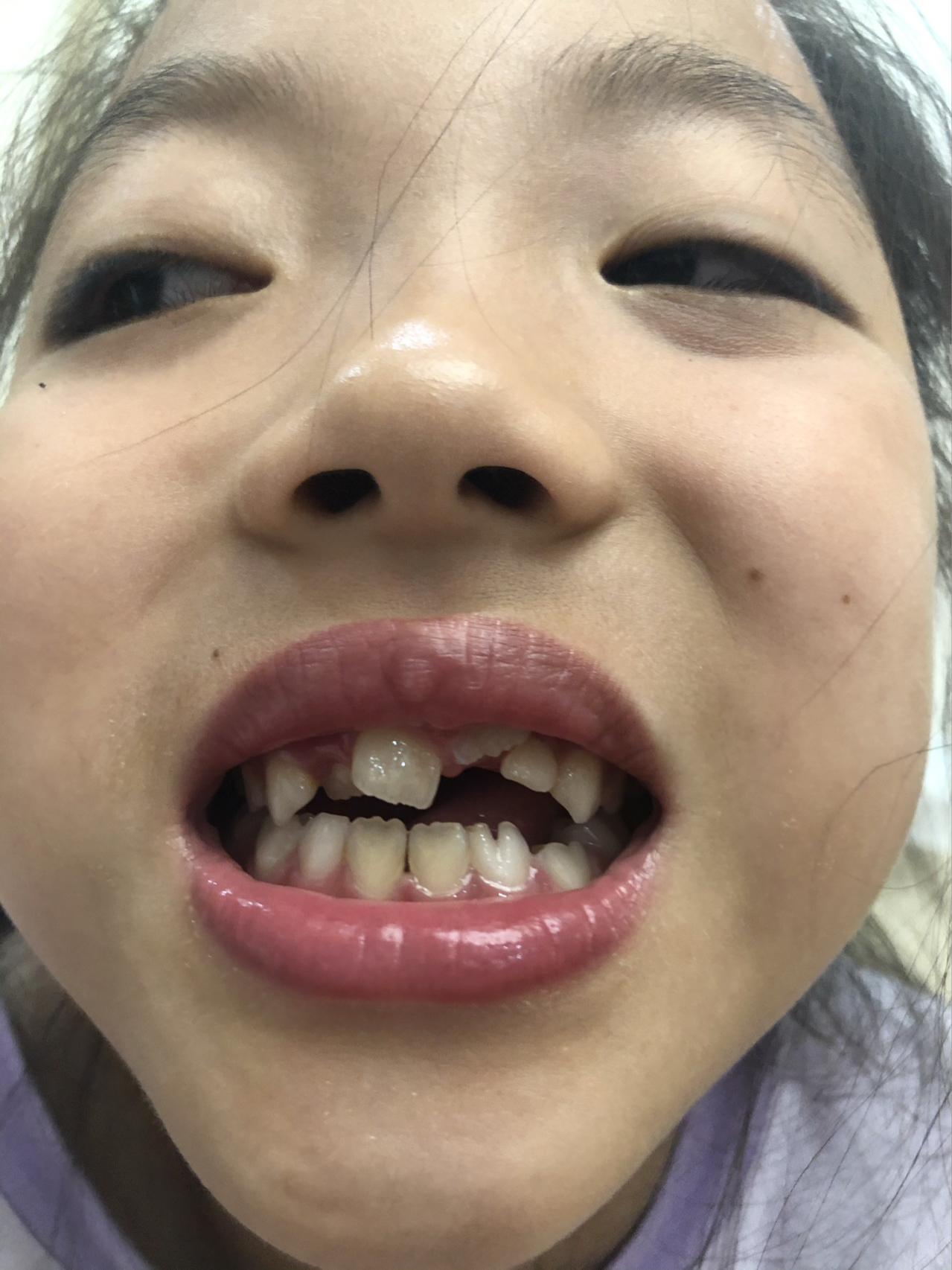 莊最新牙齒技術揭秘，牙齒美容新選擇